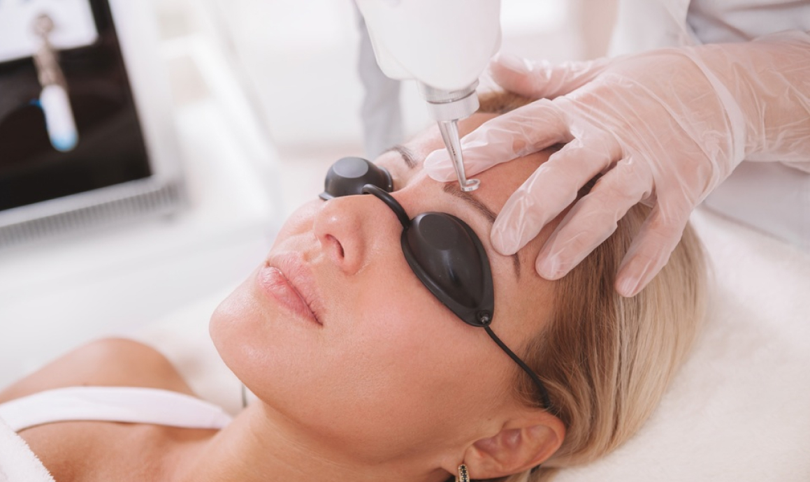 foto ilustrativa da execução do procedimento: Remoção de micropigmentação